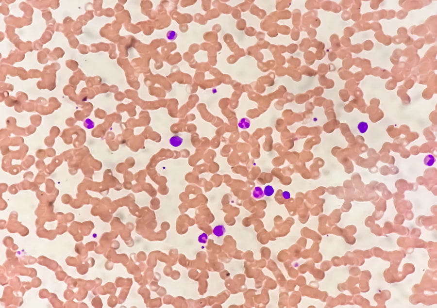 Microbiome